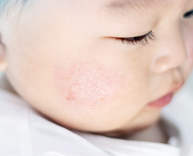 赤ちゃんからお年寄りまで誰でも通いやすい皮膚科・美容皮膚科