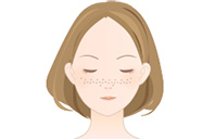 雀卵斑（そばかす）