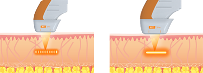 ドットモード＋リニアモード